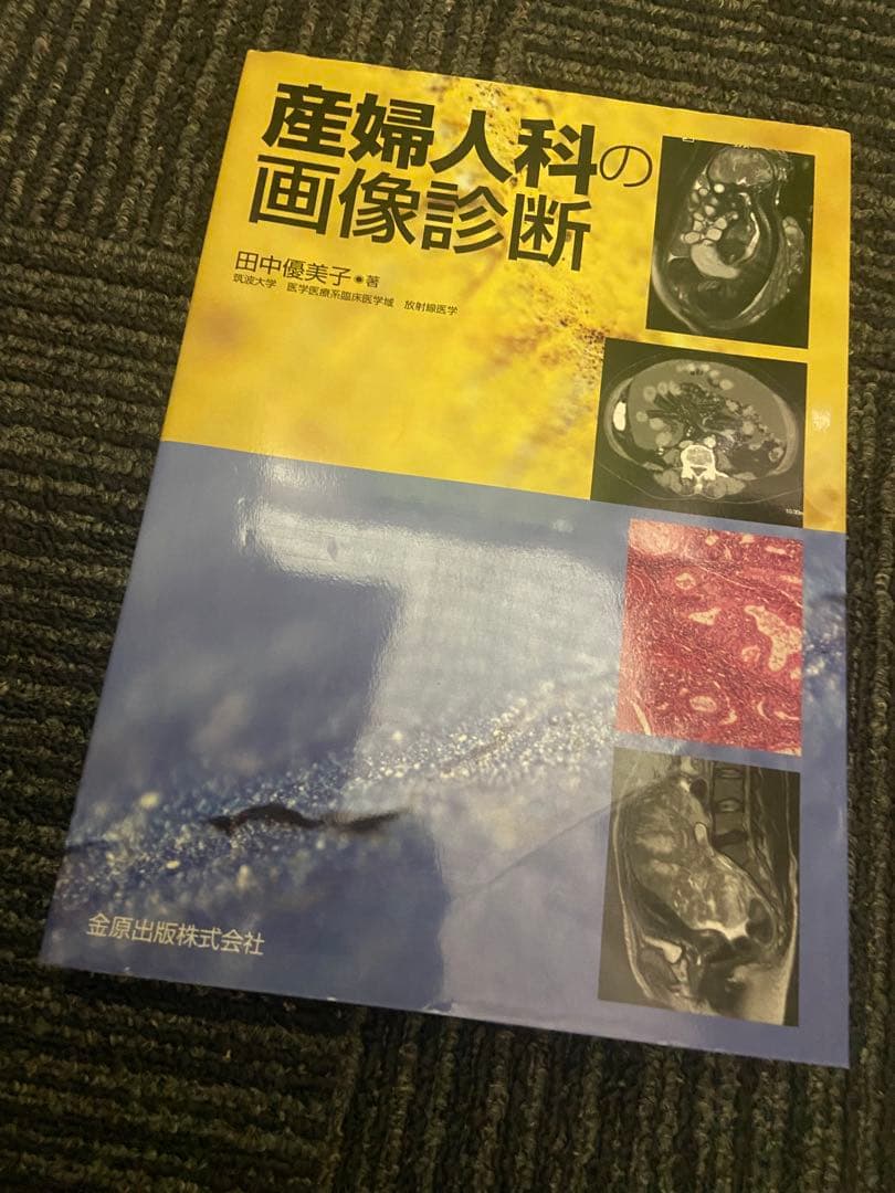 産婦人科の画像診断 田中優美子